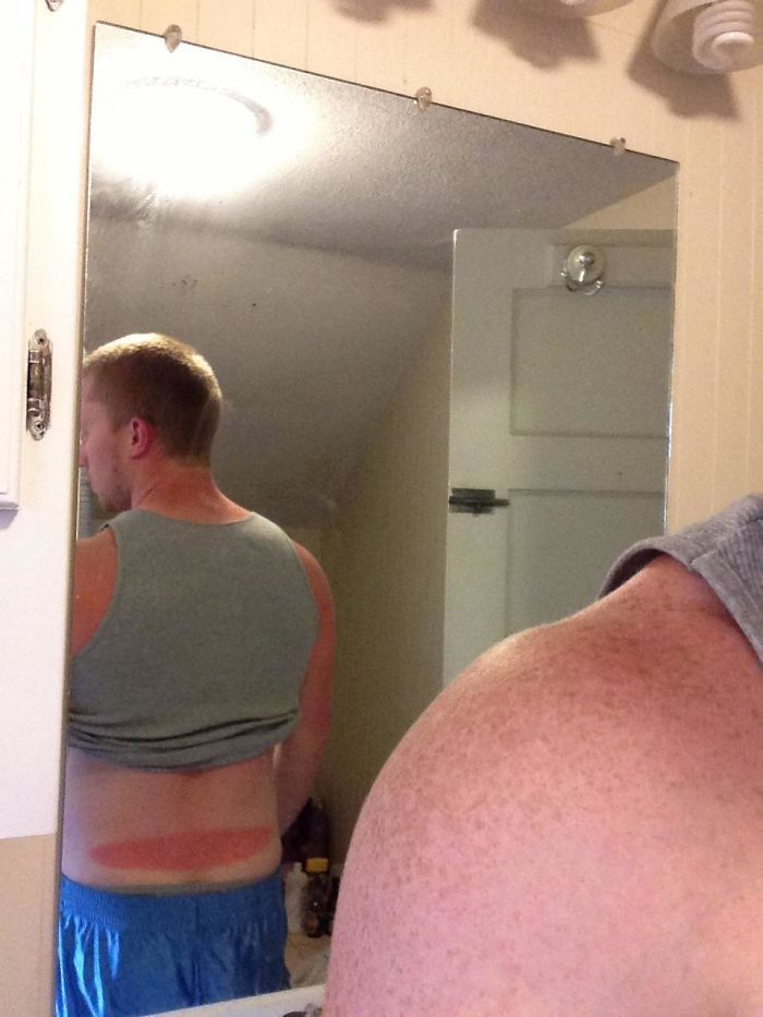 Failed Tanning (25 pics)