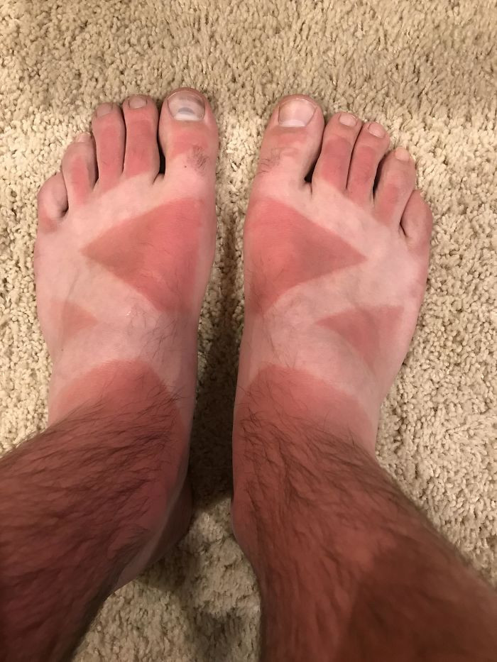 Failed Tanning (25 pics)