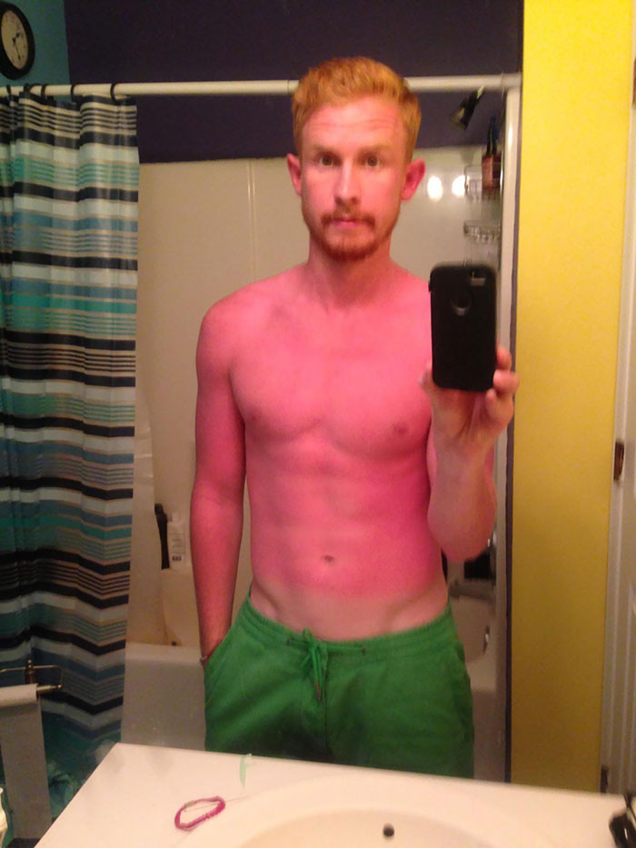 Failed Tanning (25 pics)