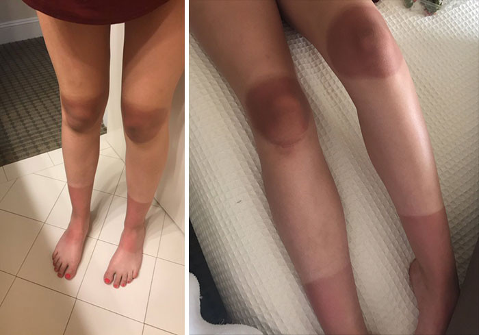 Failed Tanning (25 pics)