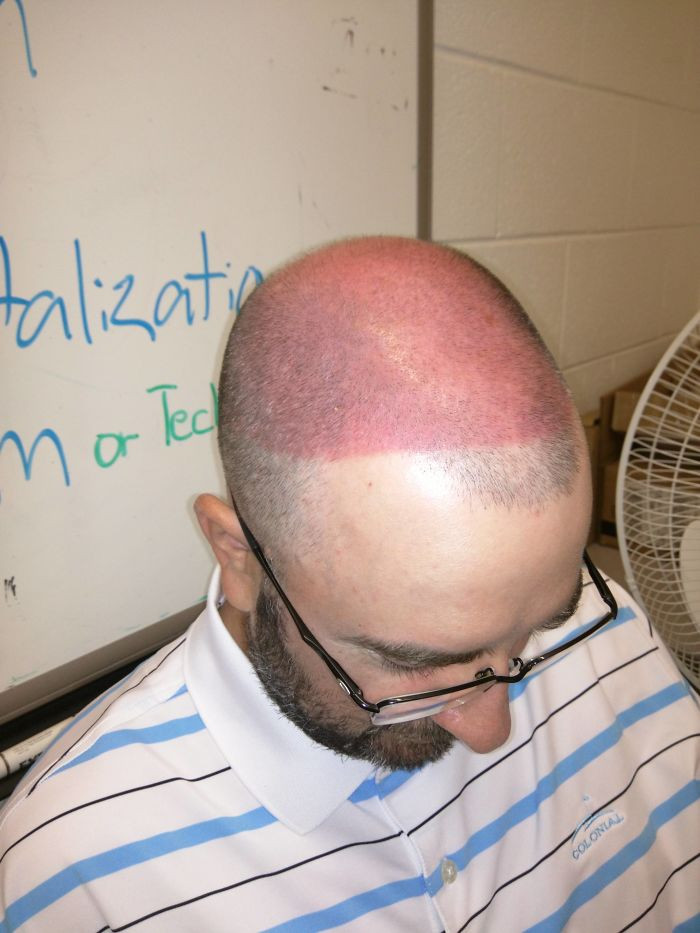 Failed Tanning (25 pics)