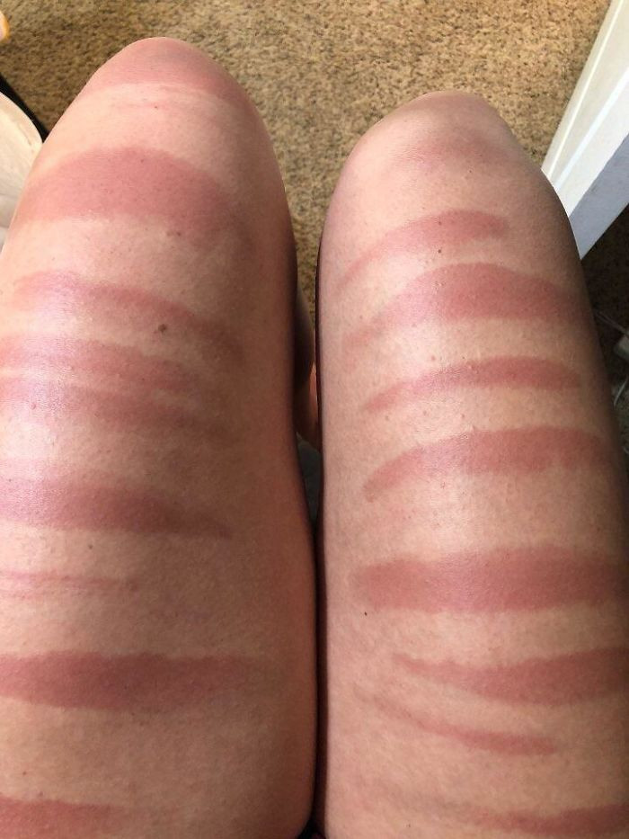 Failed Tanning (25 pics)