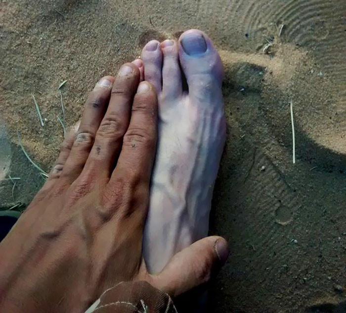 Failed Tanning (25 pics)