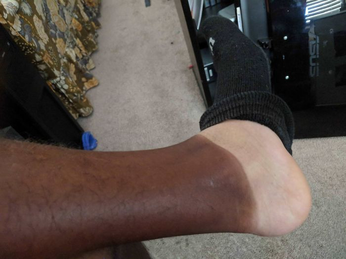 Failed Tanning (25 pics)