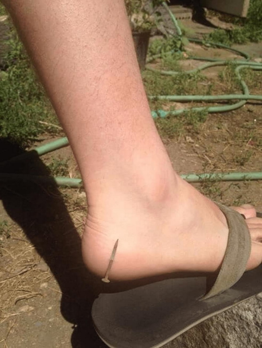 Unfortunate Situations (19 pics)