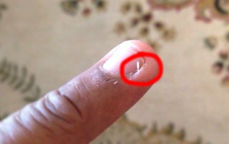 It's Annoying (21 pics)