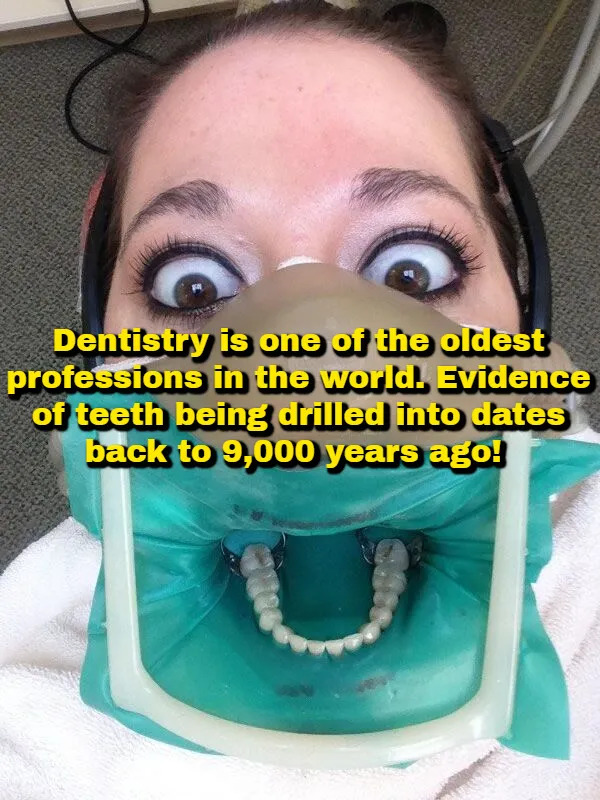 Interesting Facts (17 pics)