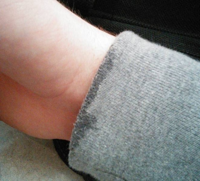 Annoying Situations (23 pics)