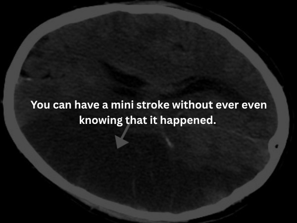 Creepy Facts (15 pics) Creepy Facts (15 pics)